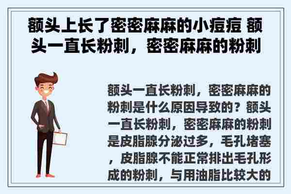 额头上长了密密麻麻的小痘痘 额头一直长粉刺，密密麻麻的粉刺是什么原因导致的？